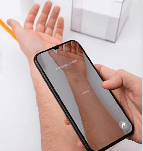 Распознавание кожных заболеваний. 